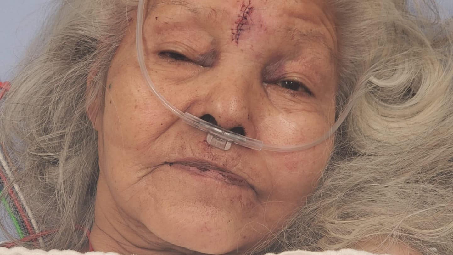 Dora Campbell, seen in a submitted photo, survived an assault and her home being burned down. The man police believe was involved is still at large.