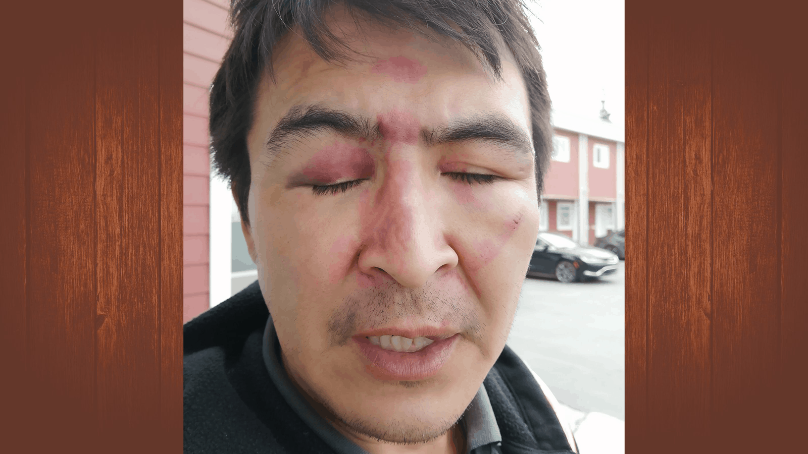 Benjamin Manuel is seen in a photo supplied to Cabin Radio by Michael Fatt