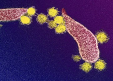 This transmission electron microscope image shows SARS-CoV-2 virus particles emerging from the surface of a cell cultured in the lab. The spikes on the outer edge of the virus particles give coronaviruses their name, crown-like. Image: NIAID-RML