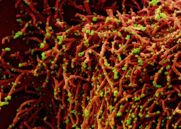 A colourized scanning electron micrograph of a cell (red) infected with SARS-CoV-2 virus particles (green). Image: NIAID-RML