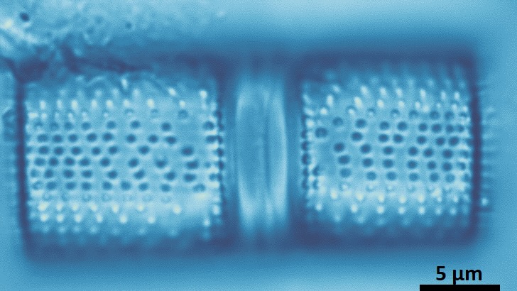 A large, heavy diatom species known as Aulacoseira islandica that dominated Great Slave Lake before 2000. Kathleen Rühland/Queen's University