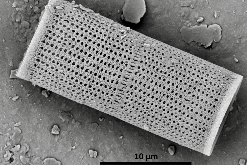 A scanning electron microscope image of Aulacoseira islandica. Paul Hamilton/Canadian Museum of Nature