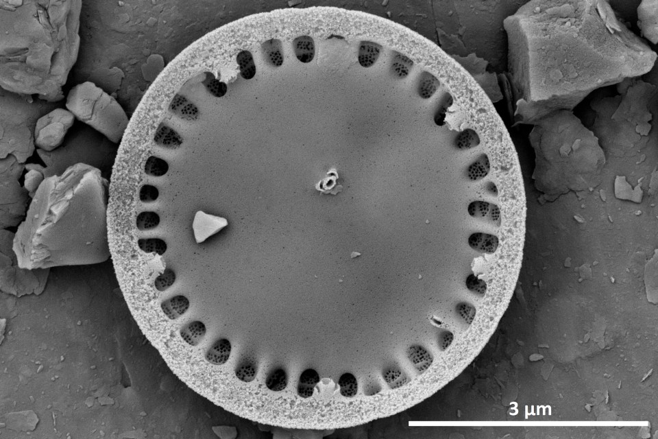 A small-celled diatom known as Discostella pseudostelligera that has proliferated in the lake since roughly 2000. Paul Hamilton/Canadian Museum of Nature